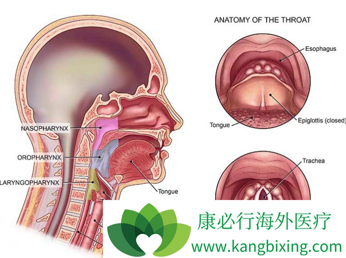 声音嘶哑是最早期最常见的咽喉癌症状