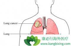 �ΰ����߼���������ǳ����ķΰ������ܻ��ã�