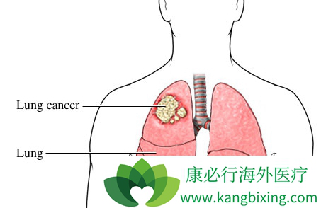 �ΰ������ܻ���