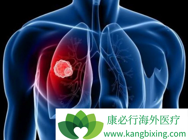 �ΰ������ܻ���