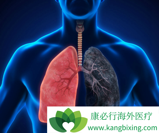 �ΰ���Ⱦ��