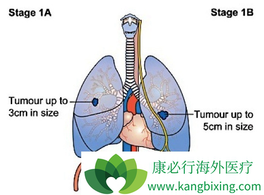 �ΰ����ڴ�Ⱦ��