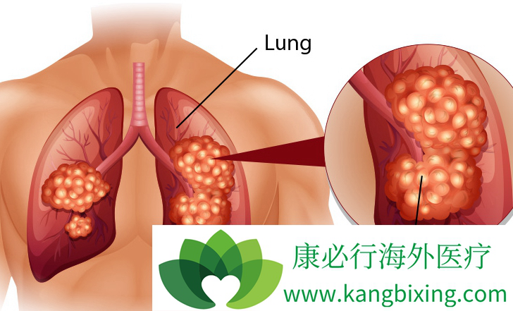 �ΰ����ڴ�Ⱦ��