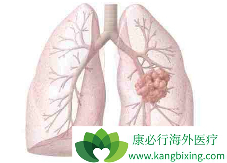 �ΰ���ת��