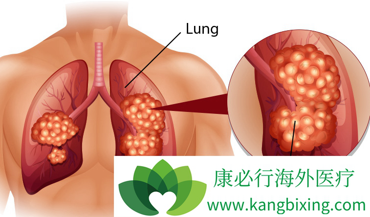 ��Сϸ���ΰ�