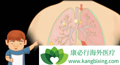 ��Ϊ���Եķΰ�������ǰ֢״