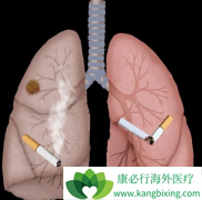 ����˻�������Եķΰ�������ǰ֢״