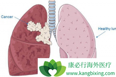 ���ڷΰ����˳�ʲô�ô��ڵ�һЩ����