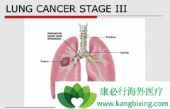 �˽�ΰ����ڵ�֢״�����ڰ������߼���ʹ��