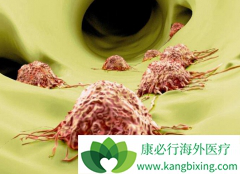 һ��ΰ����ֻ�Ƚ����ΰ�����֢״��ʲô?