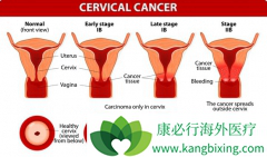 Ů�����ڹ�����֢״����Щ