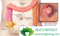 ����Ѫ����������ֱ����֢״����