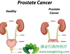 �����������ǰ���ٰ�����û�����Ե�ǰ���ٰ�֢״