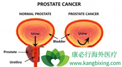 �˽�����ǰ���ٰ�֢״������������Ԥ��