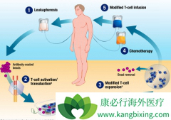 CAR-T�Ʒ��Ȱ�֢�����Ʒ�������Ϊ��֢���Ƶı�׼�Ʒ�