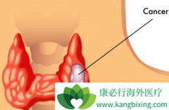 ���ڼ�״�ٰ�֢״���ֲ�����