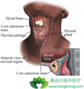 ���ڼ�״�ٰ�֢״�Ƚ����䲻�ױ�����