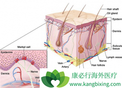 ���ڵ�Ƥ����֢״��Ϊ���׽�Ӳ�߿�״����