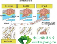 ��֢���߳��ְ�֢ת�Ƶ���Ҫԭ������Щ