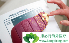 �ճ��Ӵ��ᵼ�±��δ�Ⱦ��