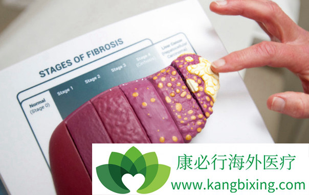 ���δ�Ⱦ��