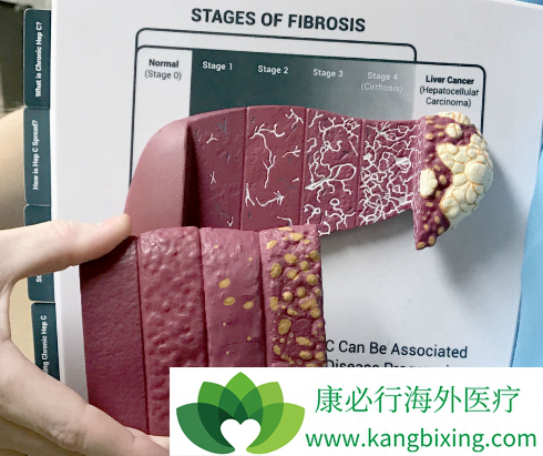 ���δ�Ⱦ��