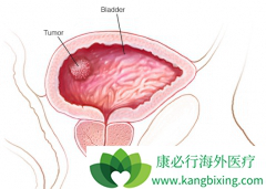 ��Ƶ����ʹ�����������ڰ��װ�֢״