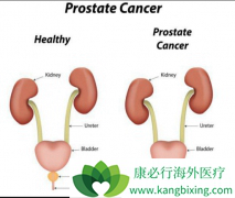 �о�����ǰ���ٰ�֢�뷼�㰷��������������ع�ϵ