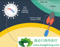 CAR-Tϸ���Ʒ������µ����ư�֢��Чҩ