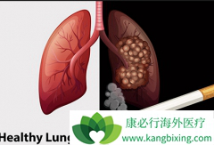 ���ڷΰ���ת�ƻ��߻���ָ�����ʹ��֢״