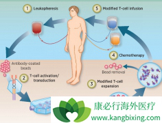 CAR-T�Ʒ��������ÿ�����ҩ���εĻ���ӭ���µ����