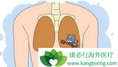 �����ٴ��Ϸΰ���ת��֢״������