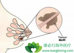 �������ٰ�֢״�������ճ�������Ҫ�������ٰ�Ԥ��