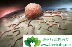 �м����Եİ�֢���Ŵ���