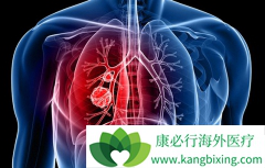 ���Ի��Ʒ����Ƿΰ���������Ʒ���