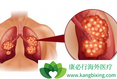 �����ΰ����ڻ��ܻ���