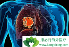 ���߷�չ���˷ΰ�������ô���ƱȽϺ�