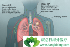 ����̵�д�Ѫ�ΰ�������ʲô֢״