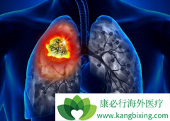 ���õķΰ���ת�Ƶ����Ʒ�������Щ