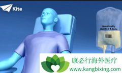 CAR-T�Ʒ���ʵ������Ч����ô��