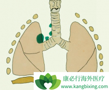 �ΰ���ת�ƺ͸ΰ�ת����ʲô��ͬ��