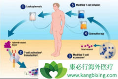 CAR-Tϸ�������Ʒ��������ٴ���ȡ���˳־õ��ٴ���Ч