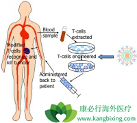 CAR-Tϸ�������Ʒ�������Щ��������