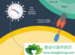 ���������Ʒ�CAR-T��ԭ����ʲô