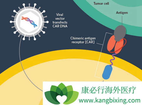 CAR-T
