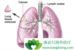 ��Сϸ���ΰ�����֢״�����֪ʶ����