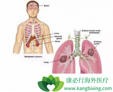 �ΰ���ת��֢״�����˽���Ԥ��