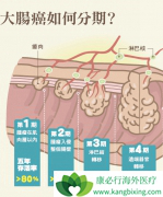 ���ڴ󳦰�֢״ͨ����̫����