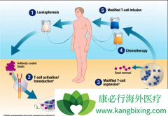 ŵ��CAR-T�Ʒ�����չ�������õ�����Ч��