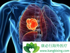 ��ͬ���͵ķΰ�Ҫ��ȡ��ͬ�����Ʒΰ��ķ���